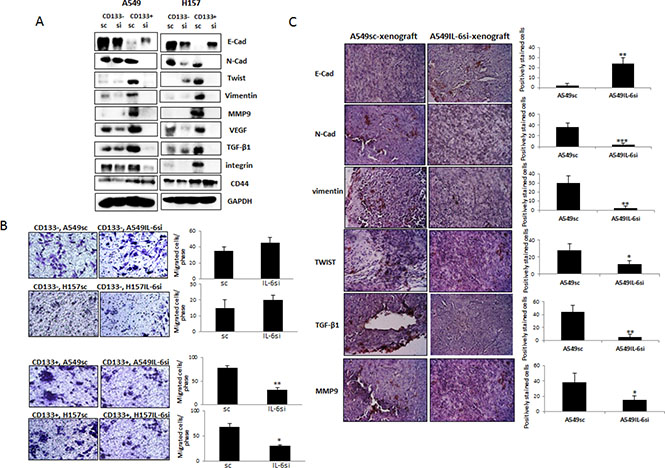 IL-6 regulation of EMT/metastasis in CD133+ cells of NSCLC.