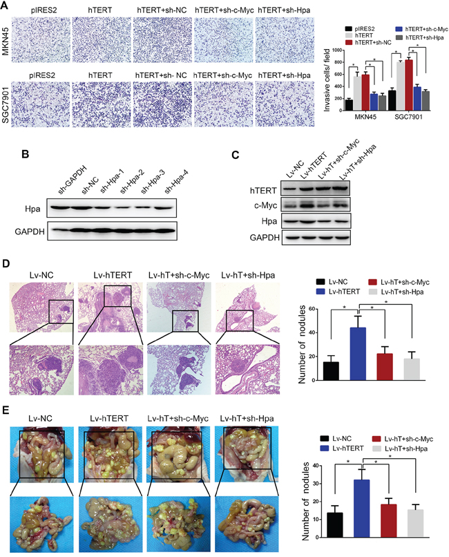 hTERT promotes the invasion and metastasis of gastric cancer cells through c-Myc and heparanase in vitro and in vivo.