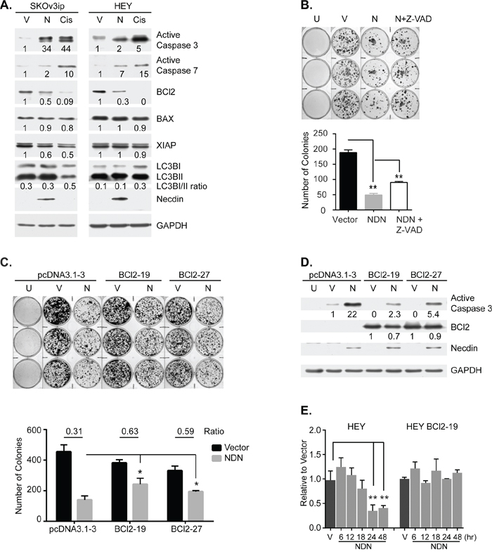 Necdin re-expression inhibits cell growth by inducing apoptosis.