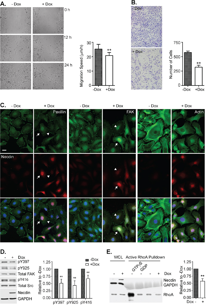 Necdin re-expression inhibits cell motility in SKOv3ip-NDN inducible cell line.