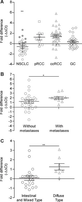 QRT-PCR gene expression analysis of MICAL2 in lung, kidney and stomach cancers.
