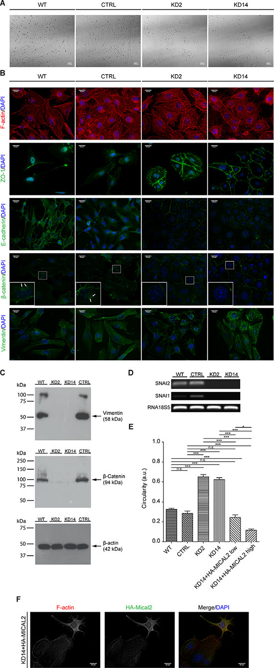 Abating MICAL2 in 786-O kidney cancer cells in vitro induces MET.