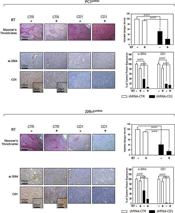 Immunohistochemistry, &#x03B1;-SMA and cyclin D1 staining in sections from mice xenografted with PC3 and 22Rv1 cell lines and subjected to radiotherapy.