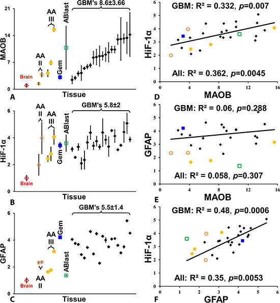 Quantification of MAOB, HiF-1&#x03B1;, and GFAP levels in gliomas.
