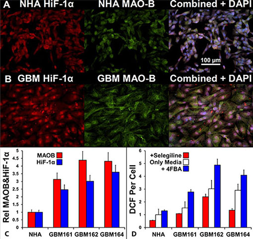 Comparison of MAOB expression, HiF-1&#x03B1; expression, and peroxide generation in response to a MAOB substrate in normal human astrocytes and glioma cells.