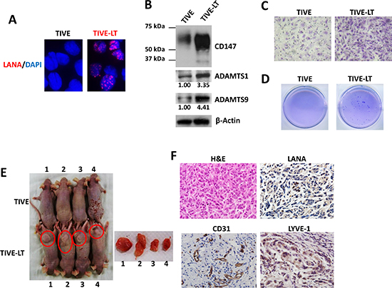 Establishment of a KS-like nude mouse model using TIVE-LT cells.