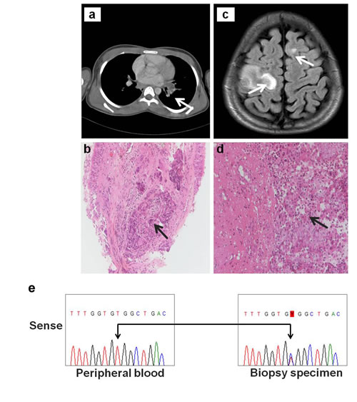 A novel HER3 somatic mutation in NSCLC.