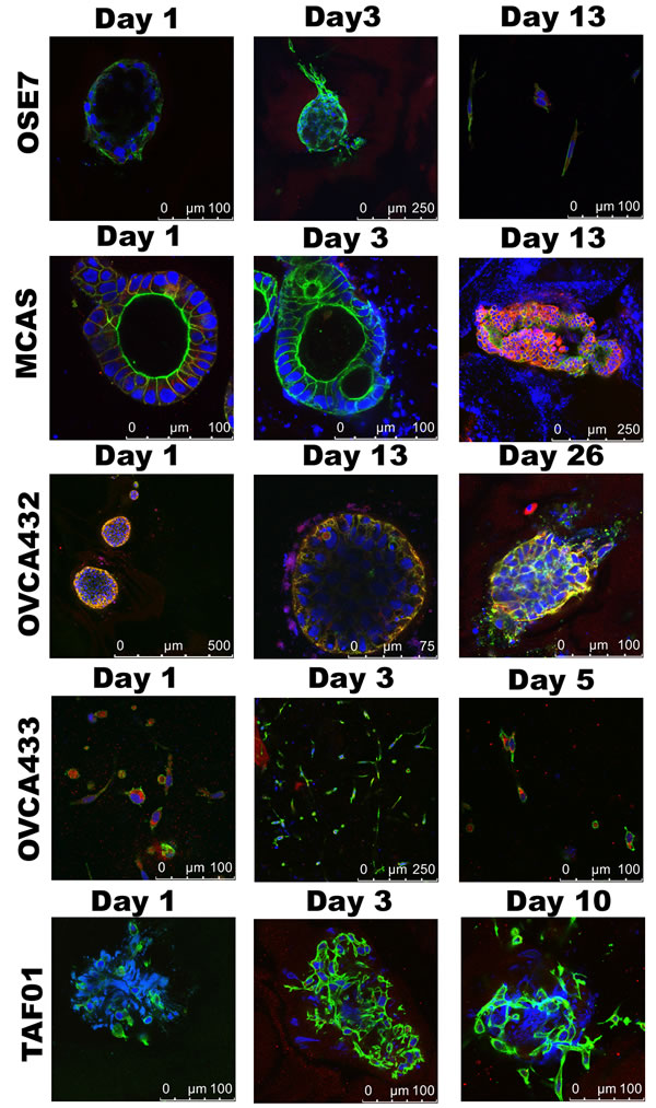 Cell migration in 3D Collagen I cultures.