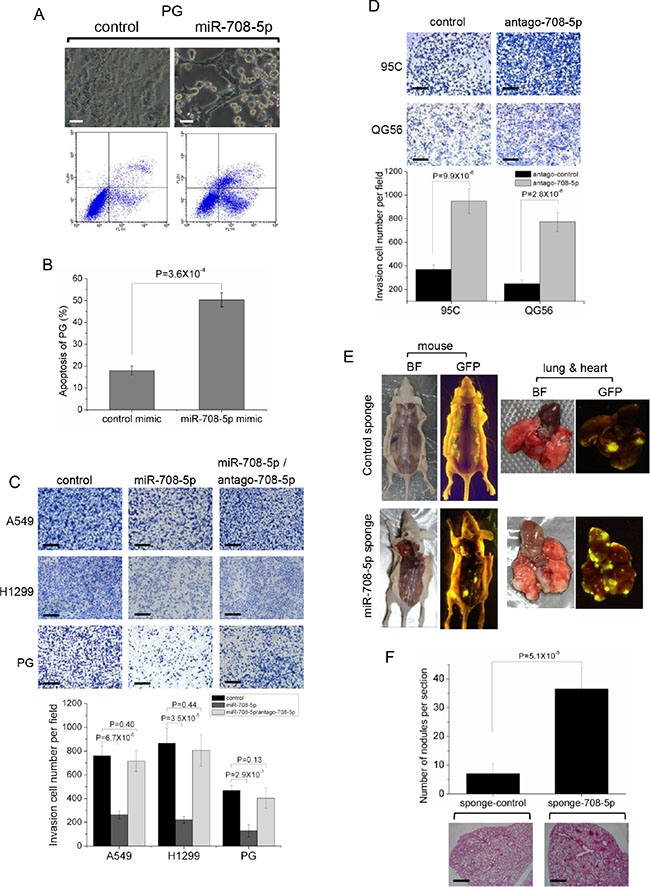 miR-708-5p induced cell apoptosis and suppressed invasive growth of lung cancer cells.