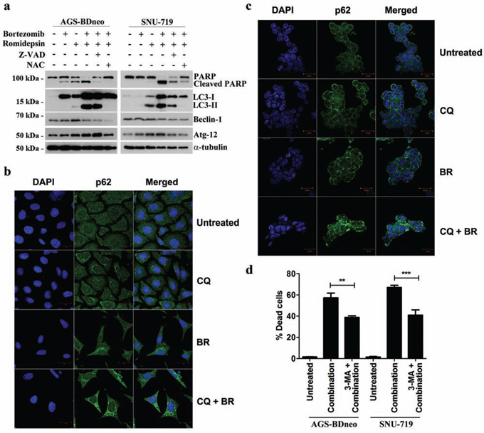 Effects of bortezomib/romidepsin on induction of autophagy in GC cells.