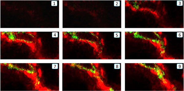Z-stack analysis of a single F4/80+ &#x03B1;-SMA+ cell undergoing the MMT process in the fibrotic kidney of UUO by confocal microscope.
