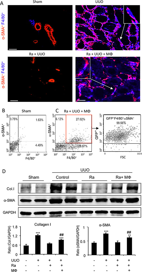 Adoptive transfer identifies bone marrow macrophages as myofibroblast precursors during renal fibrosis.