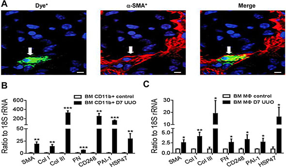 Myofibroblast transition of adoptively transferred bone marrow macrophages in the UUO kidney.