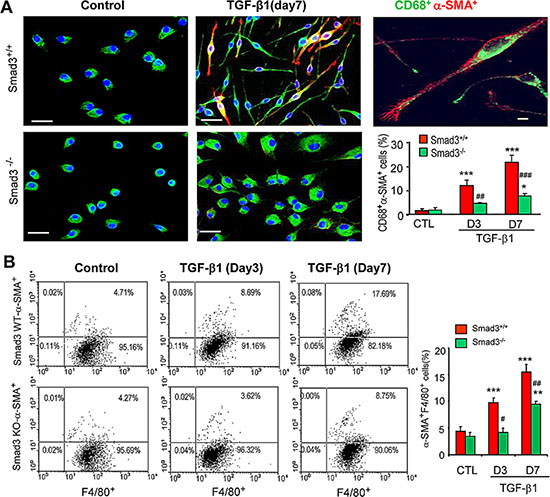 Smad3 is required for macrophage to myofibroblast transition in vitro.