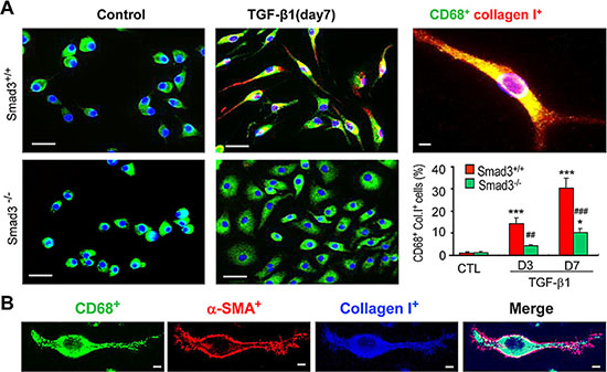 Smad3 is Required for Collagen Production by Transformed Macrophages in vitro.