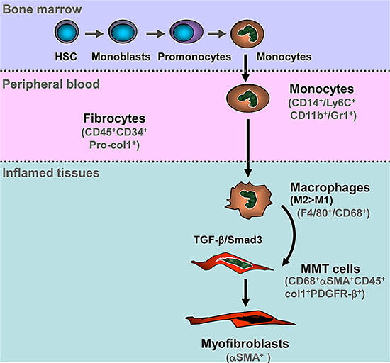 Schematic Diagram of Macrophage-Myofibroblast Transition (MMT) in Tissue Fibrosis.