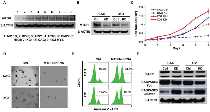 Decreased MTDH expression induces MM cell growth inhibition in vitro.