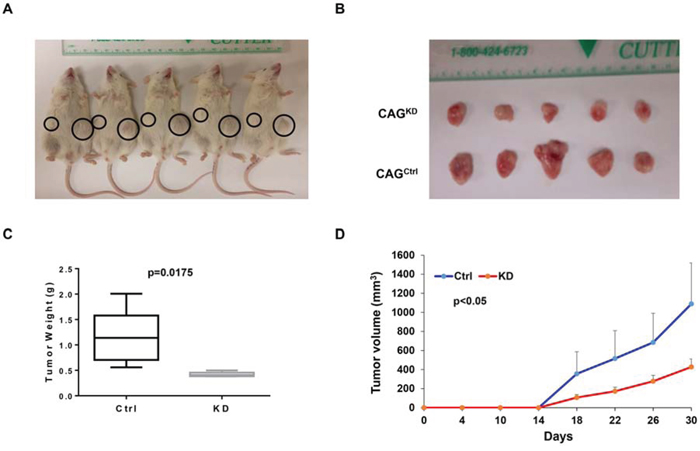 Downregulation of MTDH inhibits myeloma xenografts in NSG mice.