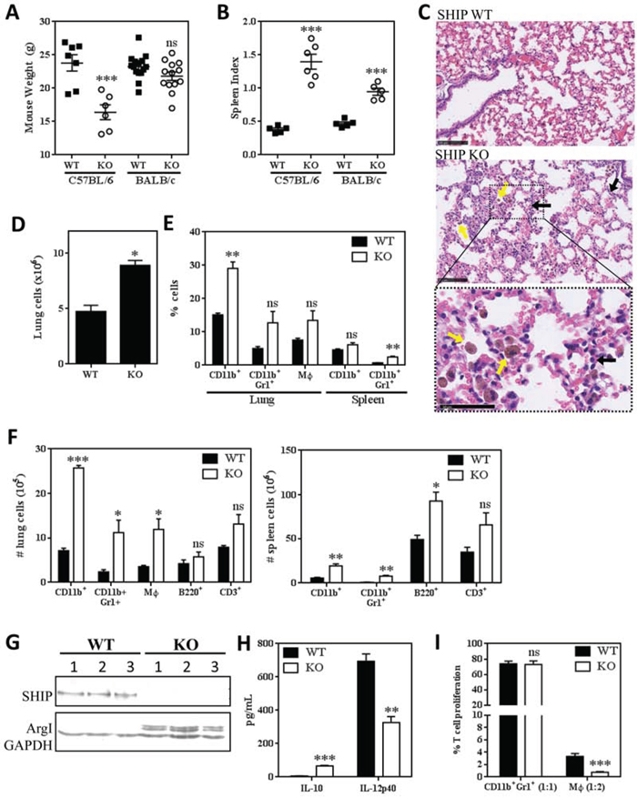 SHIP represses pulmonary inflammation and M&#x03D5; M2 polarization and immunosuppression in BALB/c mice.