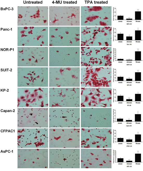 Changes in migration of PDAC cells after treatment with 4-MU or TPA by transwell migration assay (original magnification 400&#x00D7;).