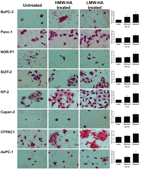 Effects of HMW-HA and LMW-HA on migration of PDAC cells assessed by transwell migration assay (original magnification 400&#x00D7;).