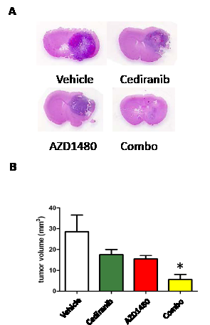 Figure3: STAT-3 blockade with cediranib reduces glioma volume.