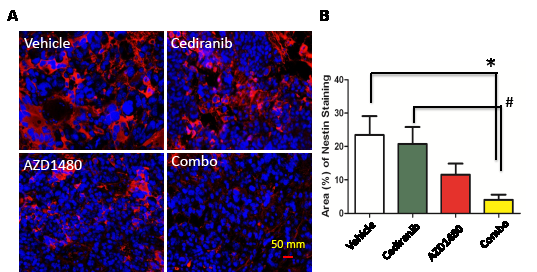 Figure6: STAT-3 blockade in GL261 tumors treated with cediranib blocks the maintenance of stem cell properties.