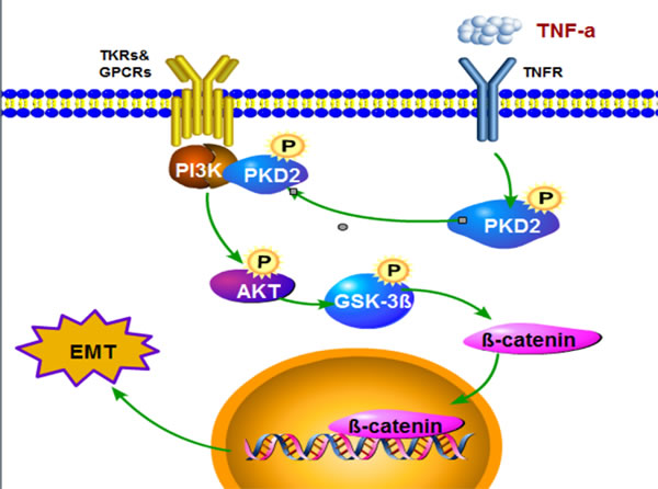 Model describing the proposed role of PKD in the control of TNF-&#x3b1;-induced EMT signaling in HCC.
