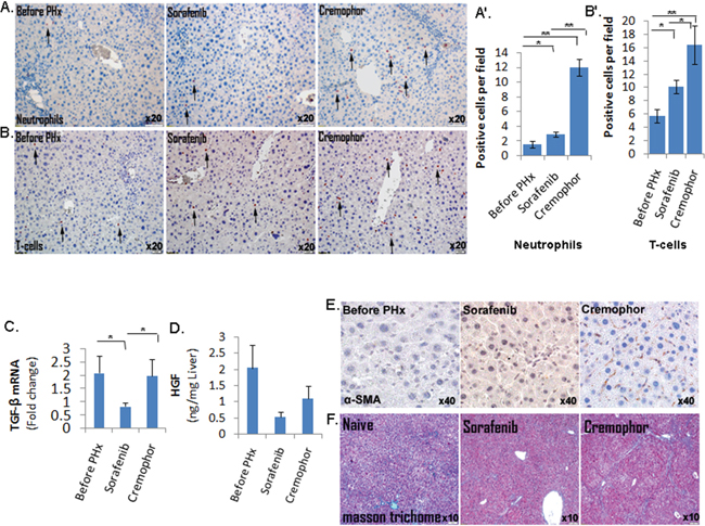 Short-term Sorafenib treatment during PHx resulted in a decreased inflammatory response and stellate cells activation.