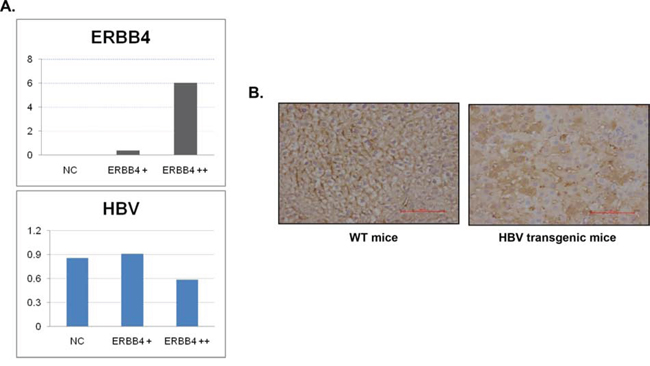 Figure 2. ERBB4 may play protective role in chronic HBV infection.