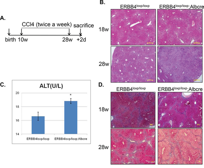 Figure 5. ERBB4 liver-specific knockout mice exhibited severe alterative inflammation after long term carbon tetrachloride (CCl4) administration.