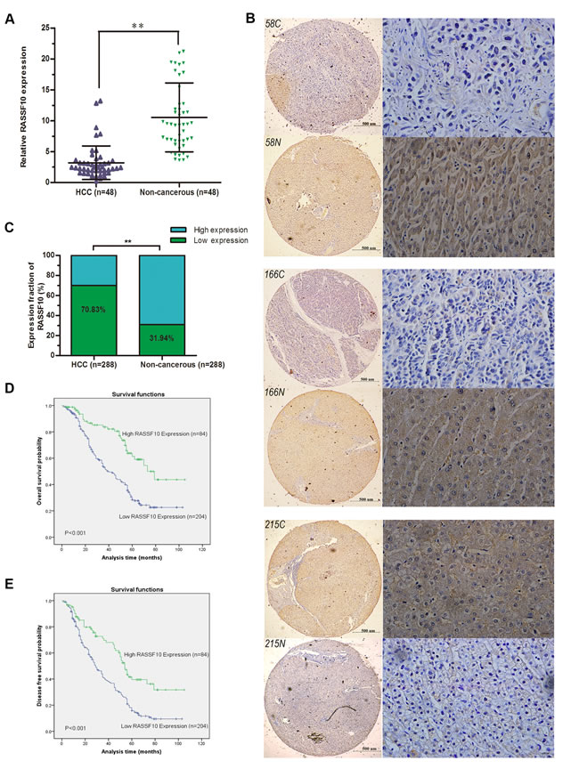 Downregulation of RASSF10 in HCC.