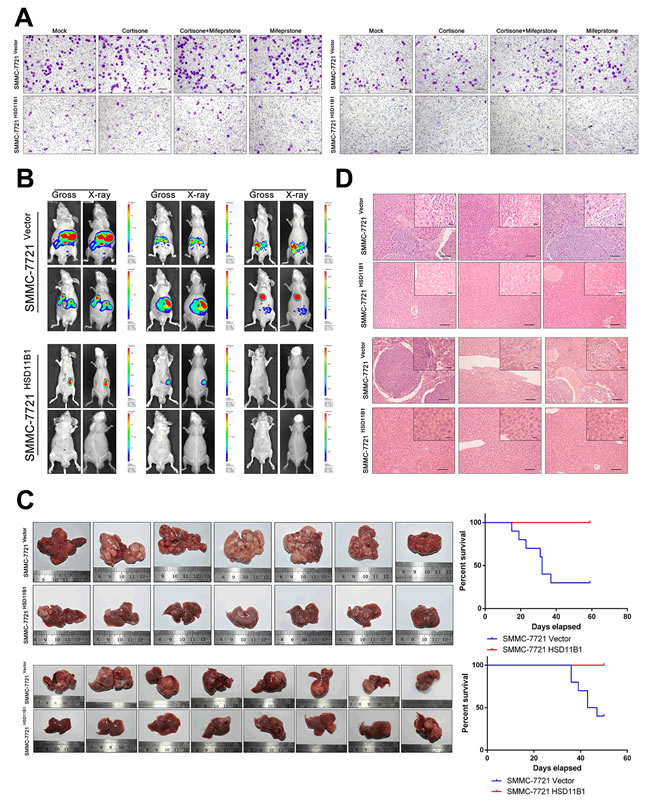 11&#x3b2;HSD1 reduces invasion and metastasis of HCC cells.