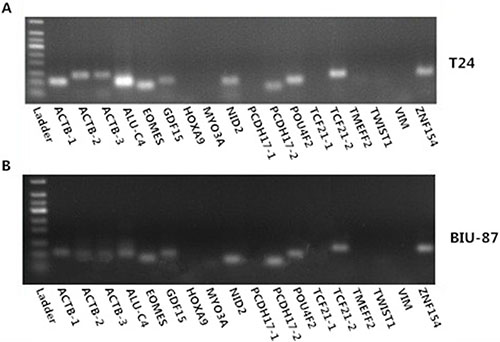 Electrophoresis chart of methylation primers in T24 (A) and BIU-87 (B) bladder cancer cell line DNA samples.