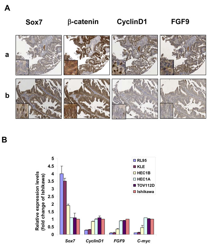 Sox7 is frequently underexpressed and inversely correlated with Wnt/&#946;-catenin signaling in endometrial cancer.