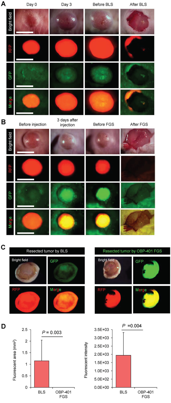 Figure 2. Comparison of OBP-401-targeted fluorescence-guided surgery with bright-light surgery for orthotopic malignant melanoma using a stationary imaging system.
