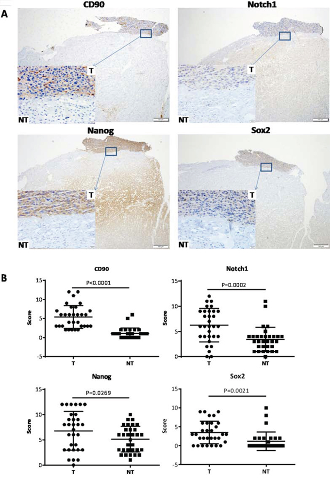 Expression of CD90, Notch1, Nanog, Sox2 in HCC and non-HCC tissues.