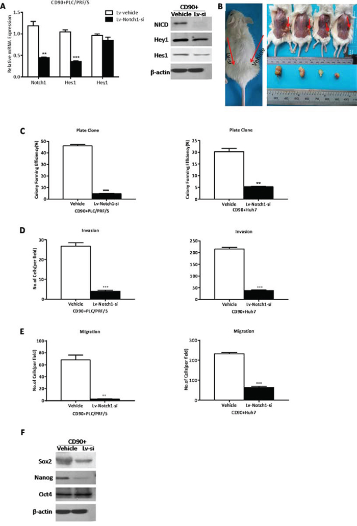The inhibition of Notch pathway attenuated the cancer stem cell properties of CD90