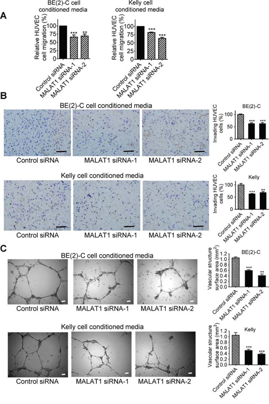 MALAT1 expression in neuroblastoma cells induces endothelial cell migration, invasion and vasculature formation.