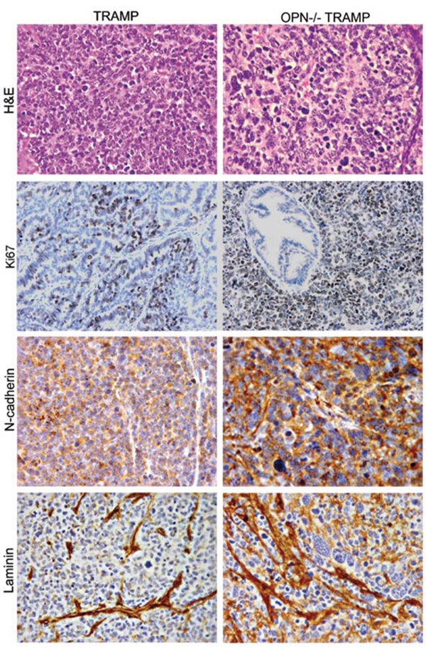 Phenotype of anaplastic lesions developing in TRAMP and OPN-/-TRAMP mice.