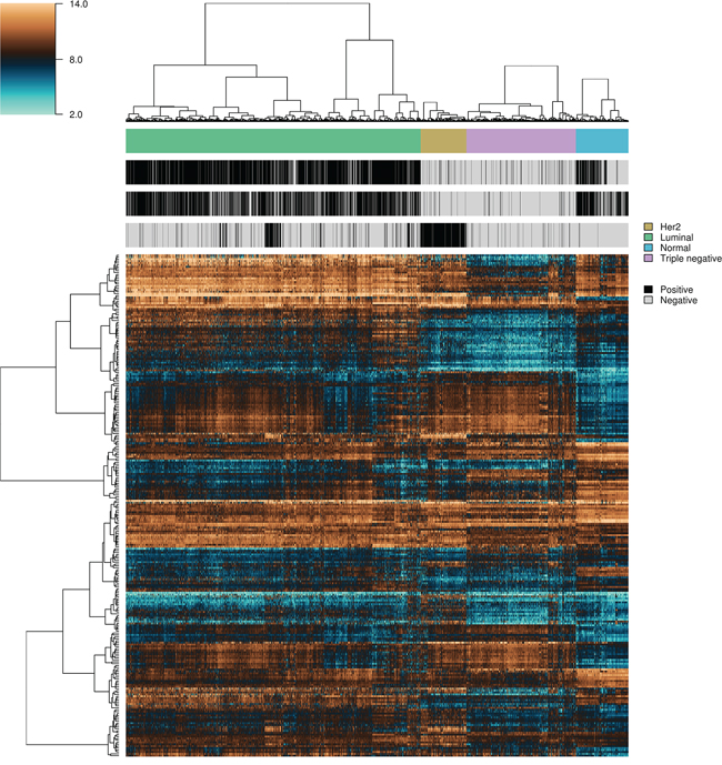 Heatmap and intra-class hierarchical clustering of 5,259 breast cancer and normal breast tissue samples.