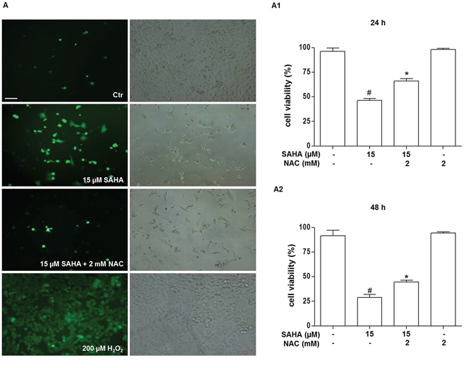 SAHA promotes ROS generation in H292 cells.
