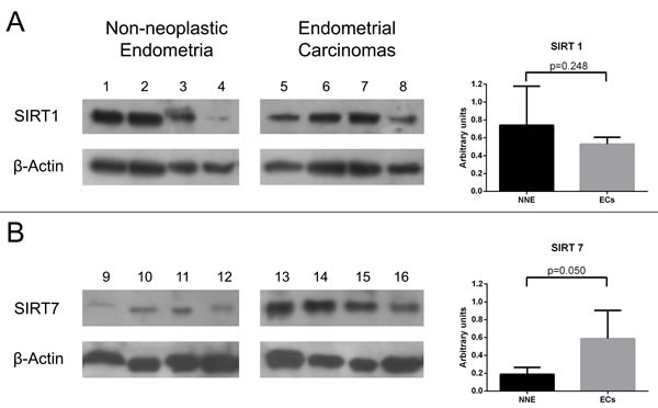 Western-blot analysis for SIRT 1 (A) and SIRT 7 (B) proteins using non-neoplastic endometria (NNE) and endometrial carcinoma (EC) samples.