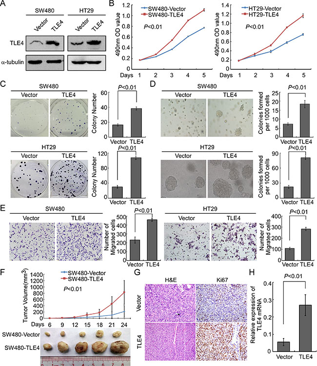 Up-regulation of TLE4 promotes cell proliferation and invasion activity of CRC cells.