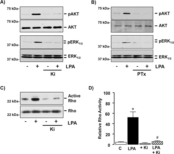 LPA regulates G-protein-dependent intracellular signaling in SKHep1 cells via LPAR1 and/or 3 in vitro. (A)