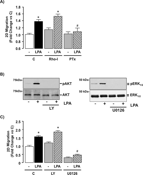 LPA-mediated cell migration is Gi-protein dependent in SKHep1 cells in vitro.