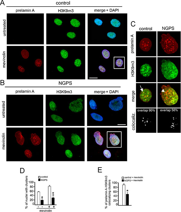 NGPS BAF mutation impairs prelamin A-related H3K9m3 intranuclear clustering.