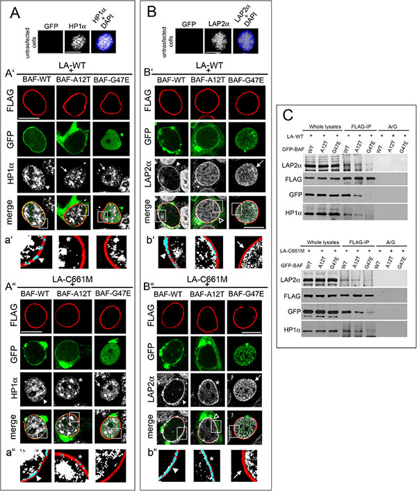 BAF governs HP1-alpha and LAP2-alpha nuclear relocalization in prelamin A accumulating cells.