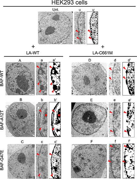 Electron microscopy evaluation of prelamin A/BAF complex effects on chromatin organization.