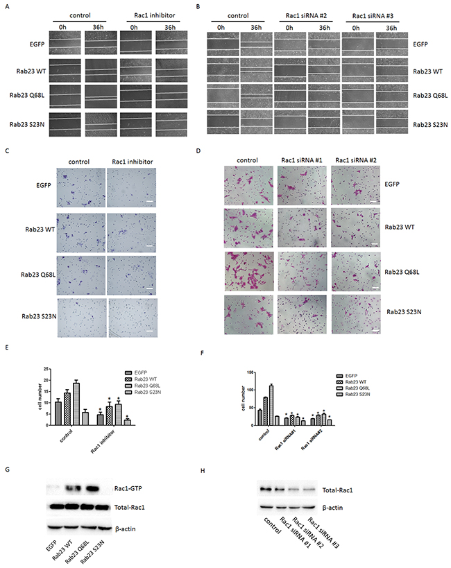 Rab23-promoted squamous cell carcinoma cells migration and invasion requires activation of Rac1.